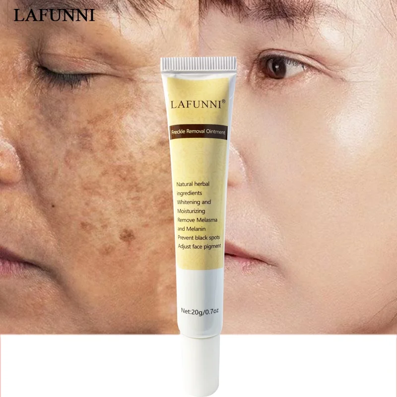 LAFUNNI Whitening Freckle Cream Face Moisturizing Remove Dark Spots Melanin Melasma Remover Brightening Skin Effective Repair An