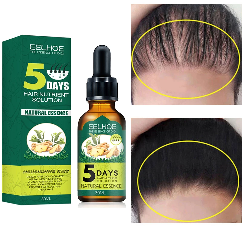 

5 Days Ginger Hair Growth Essential Oil Anti Hair Loss Prevent Baldness Treatment Fast Growing Nourish Dry Damaged Hair Care