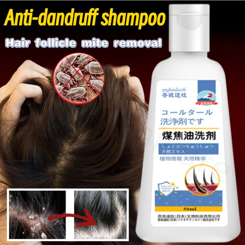 

Hair and Scalp Care 50ml Antipruritic Antibacterial Antidandruff Antipruritic Oil Control Shampoo for Improving Folliculitis