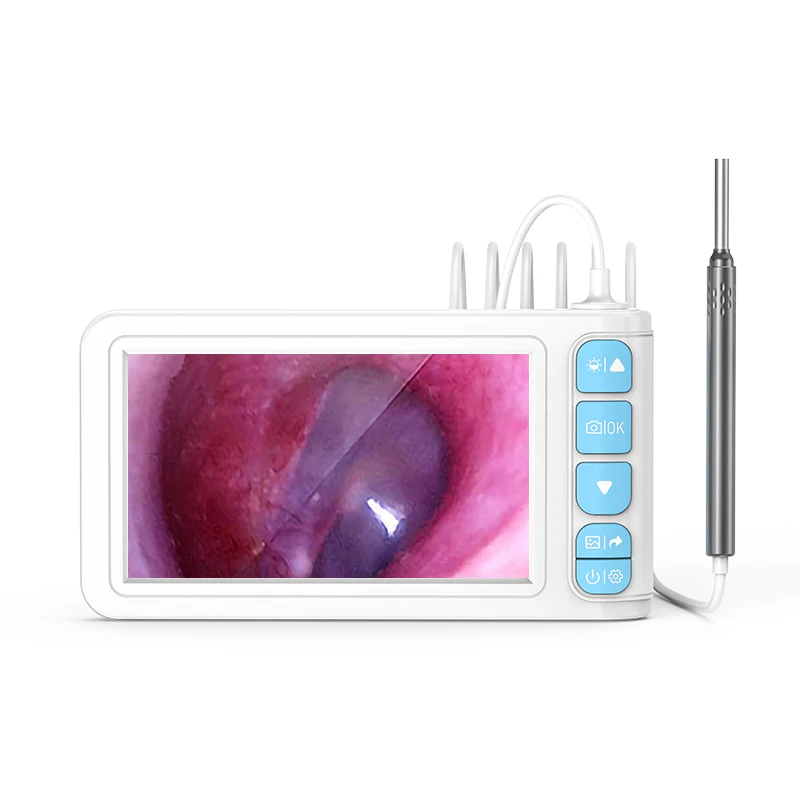 P90 Эндоскоп для удаления ушной серы 3 9 мм 4 3-дюймовый ЖК-экран Отоскоп чистки ушей