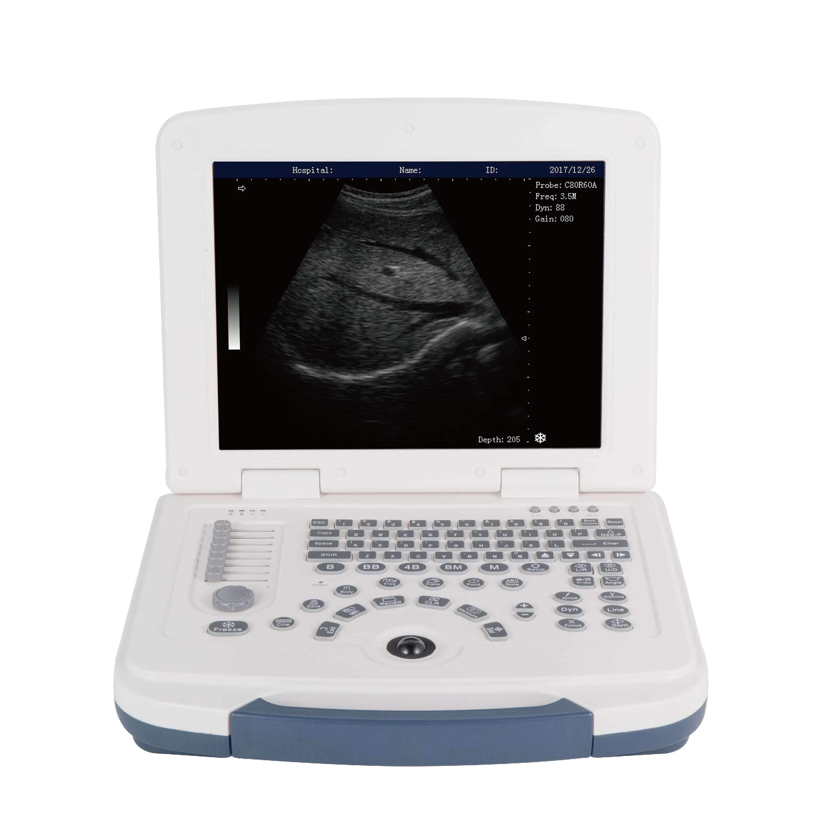 

OEM Newest Economical portable ultrasound machines for sale