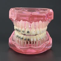 dental with metal ceramic bracket braces orthodontic model pink teeth study model 3003