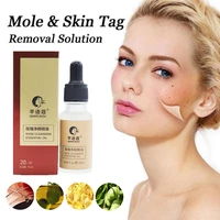 mole skin tag removal solution painless mole skin dark spot removal face wart tag freckle removal cream oil plaster