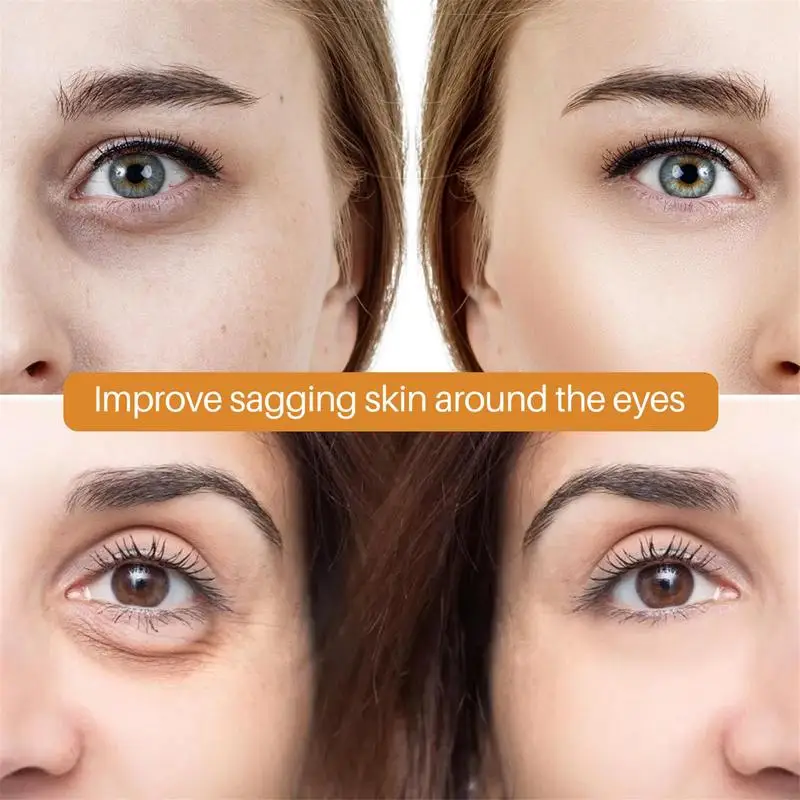 Рисунок 4 - Средство от темных кругов под глазами для женщин