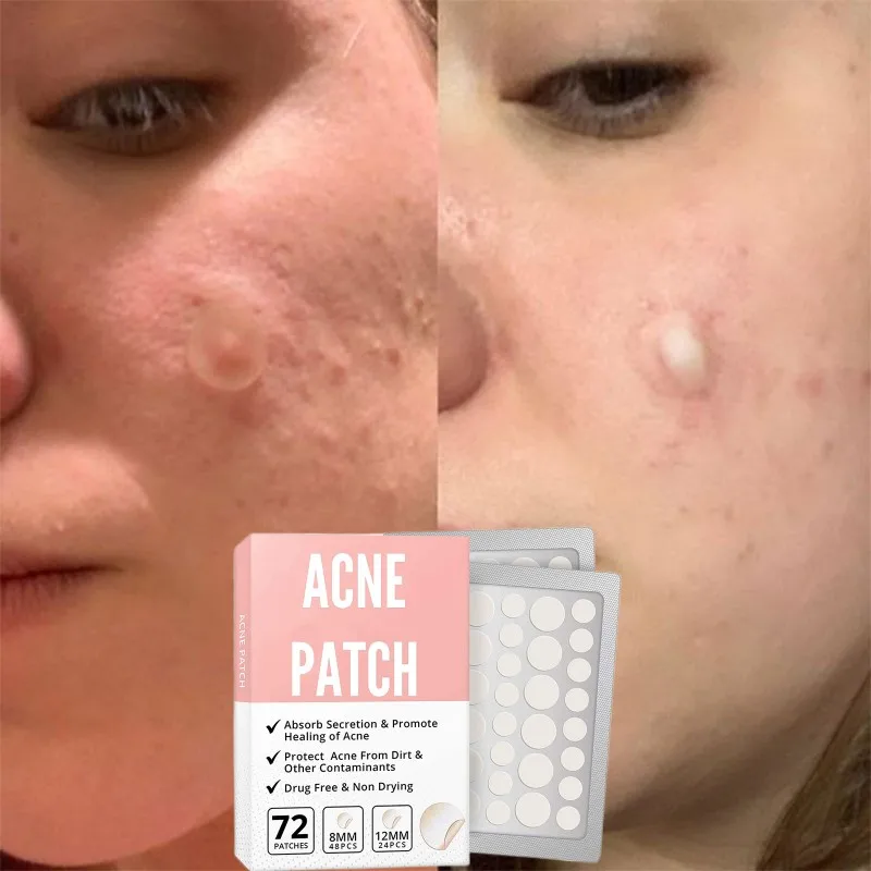 

Invisible Acne Patches Removal Pimple Anti-Acne Hydrocolloid Patches Spots Marks Concealer Repair Sticker Waterproof Wholesale