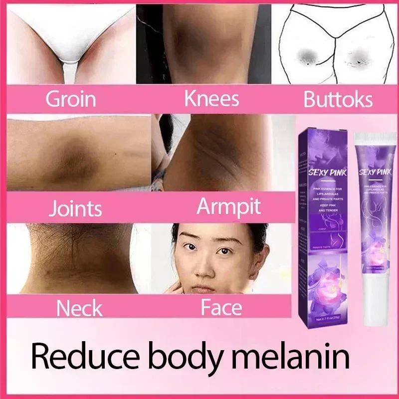Отбеливающий крем для кожи осветления темной отбеливающий интимных частей рук