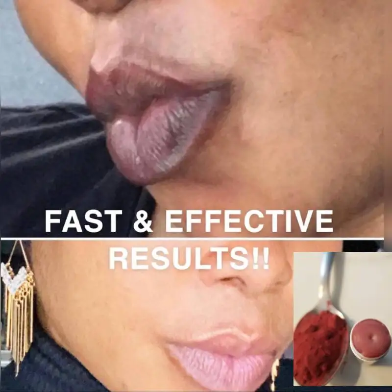 3 pcs Pink Lip Lightening Cream Solution - Dark Lip Corrector Permanent Pink Lips Smokers Lip Cream Dark Lips Cream Lip Care