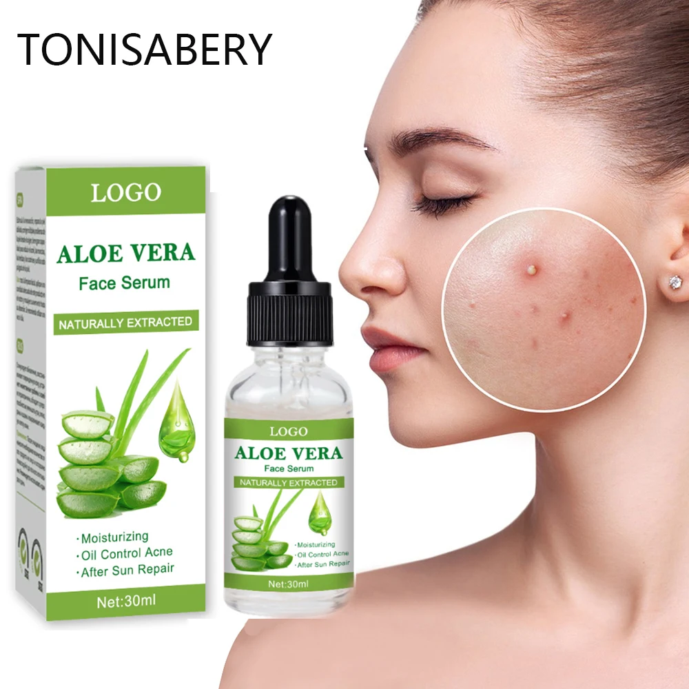 

Aloe Acne Remover Face Serum Anti-acne Oil Control Shrinking Pores Moisturizing Essence Removal Acne Marks Whiten Brighten Care