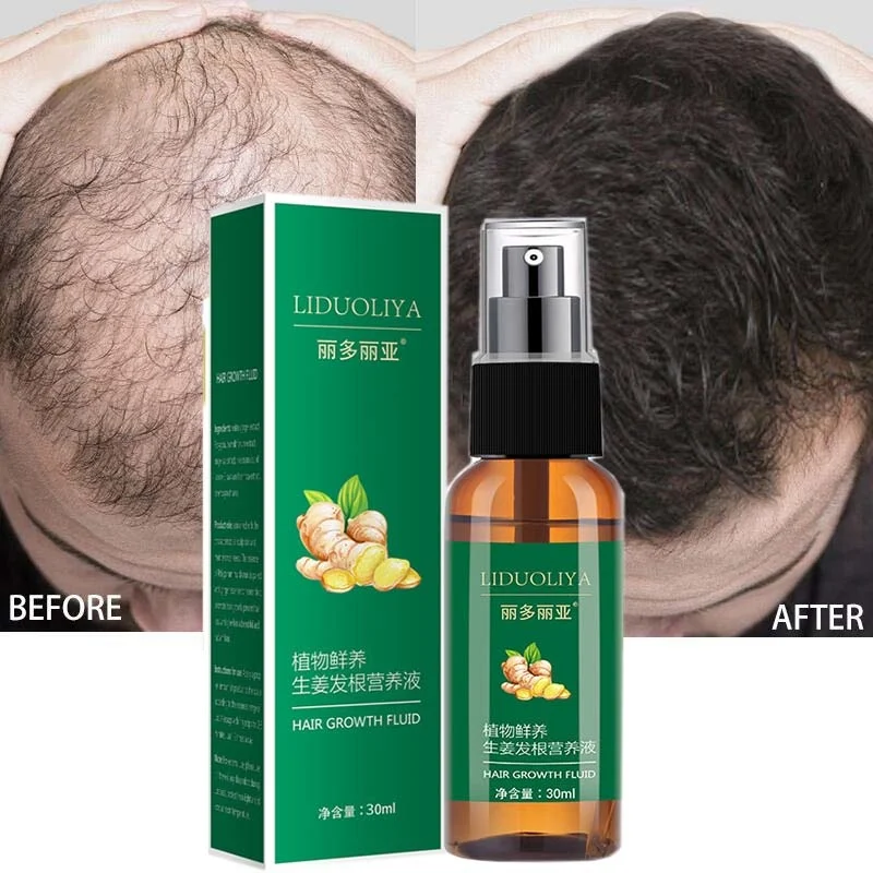 

Ginger Hair Growth Spray Serum Anti-hair Loss Beauty Fast Treatment Products Nourishing Scalp Prevent Frizzy Damaged Repair Care
