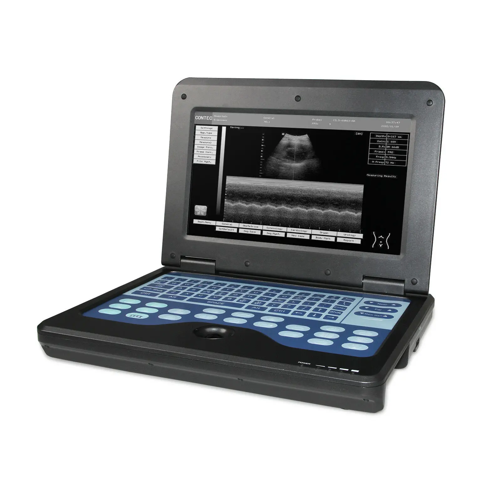 

CONTEC Certifications CMS600P2 10.1 inch Digital laptop ultrasound scanner