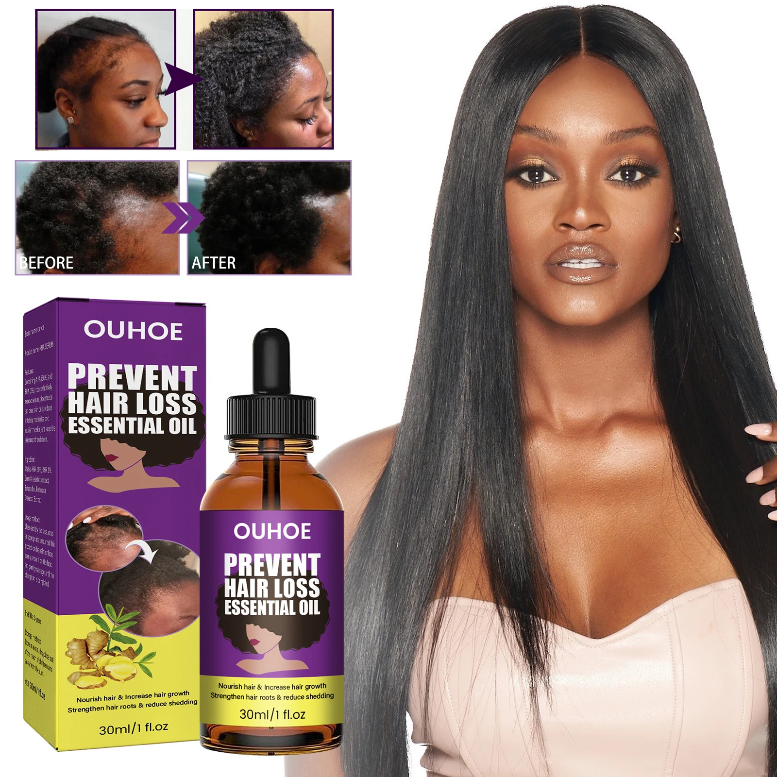 

Africa Wild Ginger Hair Growth Essential Oil Traction Alopecia Hair Loss Prevent Edges Bald Spots Thinnin Increasing Soften Hair