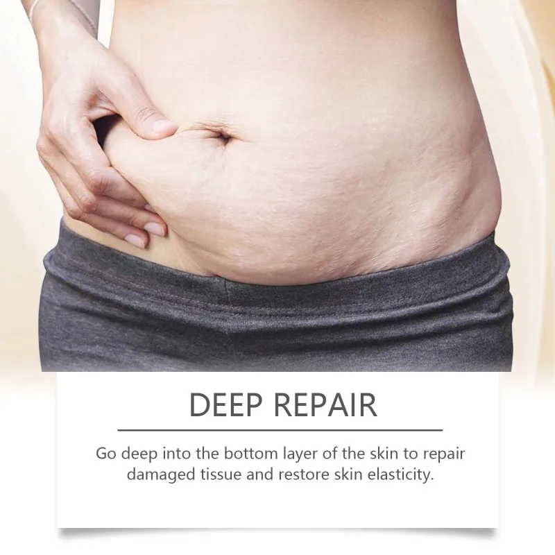 Масло для удаления растяжек средство беременных против морщин лифтинг кожи