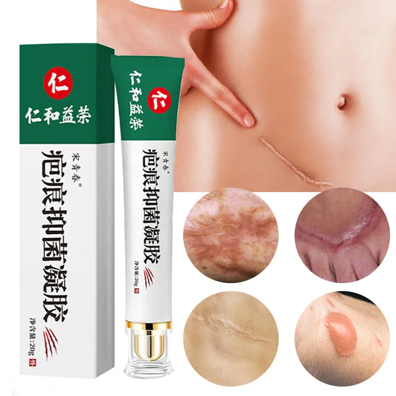 20G  Cream Acne Cream Body Bump Scald Burn Surgery Acne Pit Acne Print Stretch Mark Repair Gel Unisex