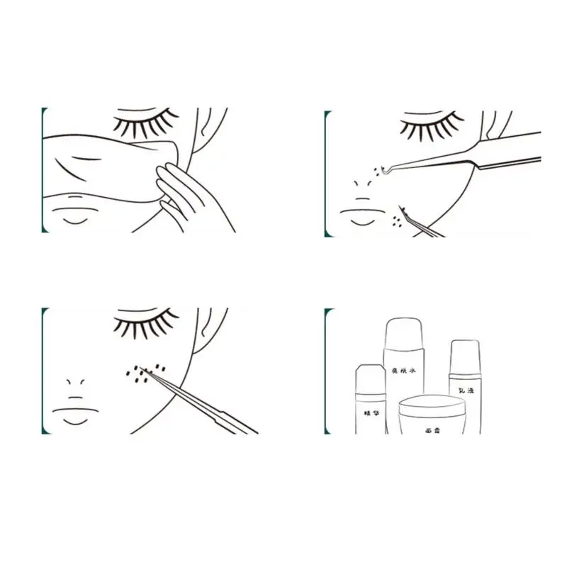 Пинцет Для Удаления чёрных точек в клеточках Специальная игла для соскабливания