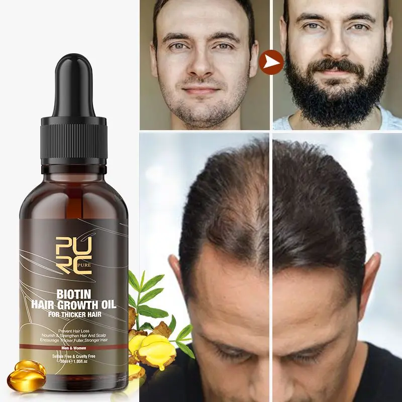 

Biotin масло для роста волос и бороды для мужчин и женщин, имбирное средство для лечения выпадения волос и кожи головы, сыворотка для волос с ви...