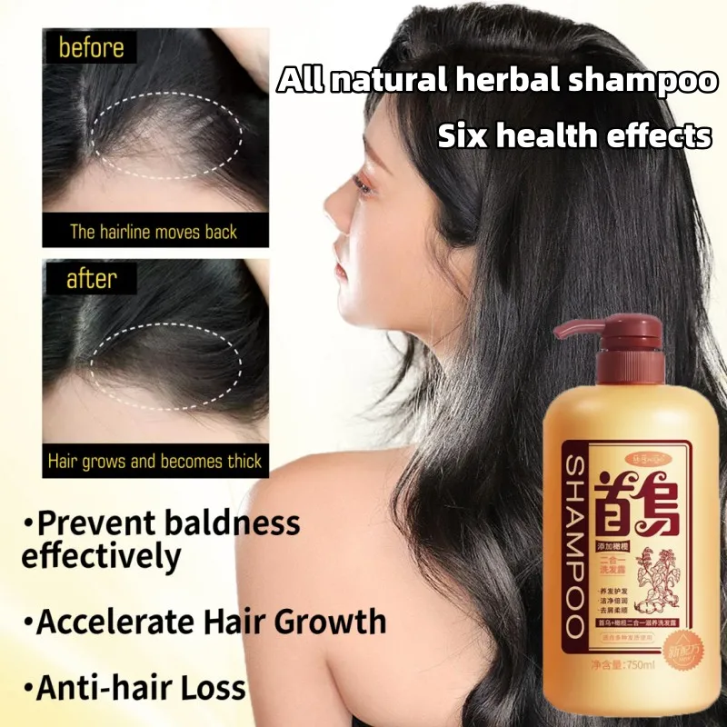 

Polygonum Multiflorum Permanent Black Hair Oil Control Anti-dandruff Shampoo Nourishes Scalp Anti-hair Loss 750ml