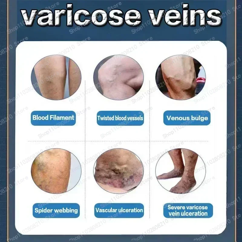 Китайская натуральная травяная медицина искусственная кожа воспаление vasculite