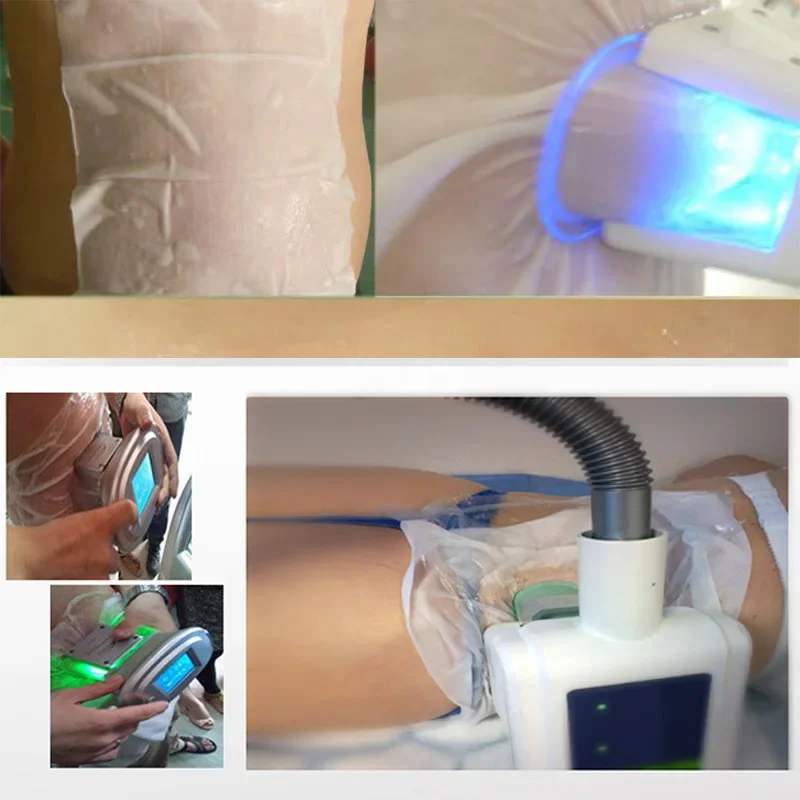 Мембраны антифриза для замораживания жира 50 шт.