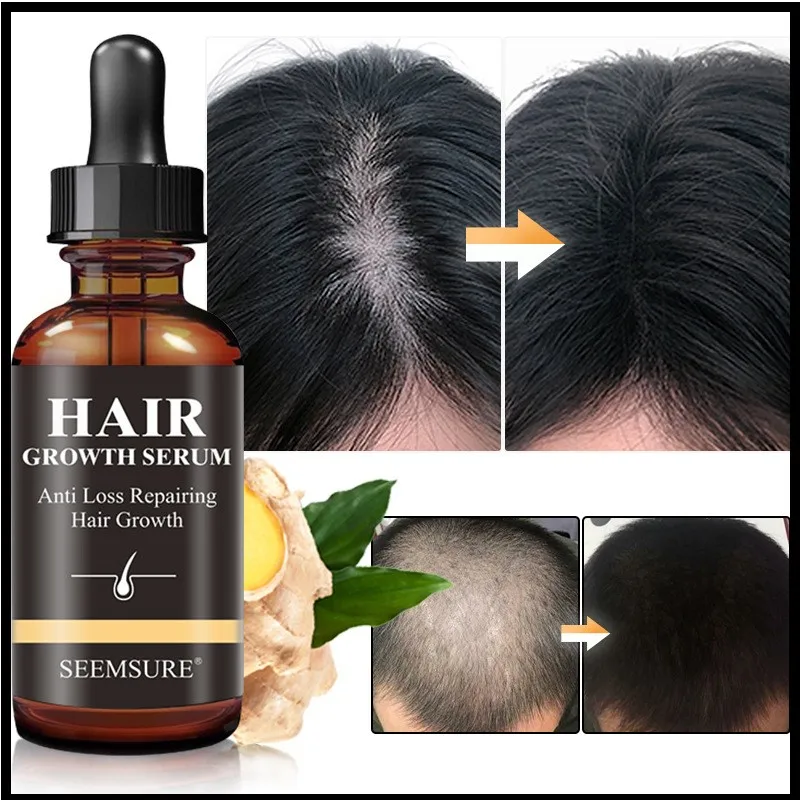 

Ginger Hair Growth Essential Oi Hair Loss Treatment Prevent Hair Dry Frizzy Damaged Thinning Serum Liquid Nourishing Repair Care