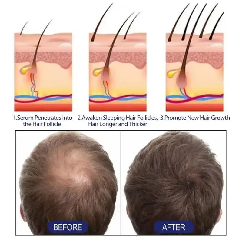 27 5 г Средство от выпадения волос Волокна Кератиновый спрей для утолщения