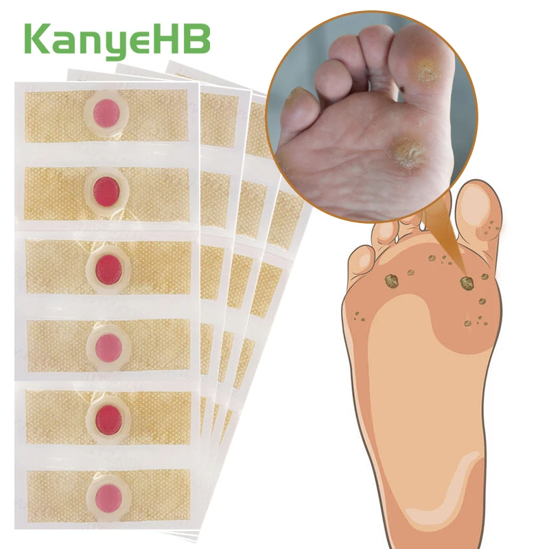 

24Pcs Plantar Warts Removal Patches Foot Corn Calluses Thorn Medical Detox Patches Relief Pain Herbal Foot Care Stickers A174