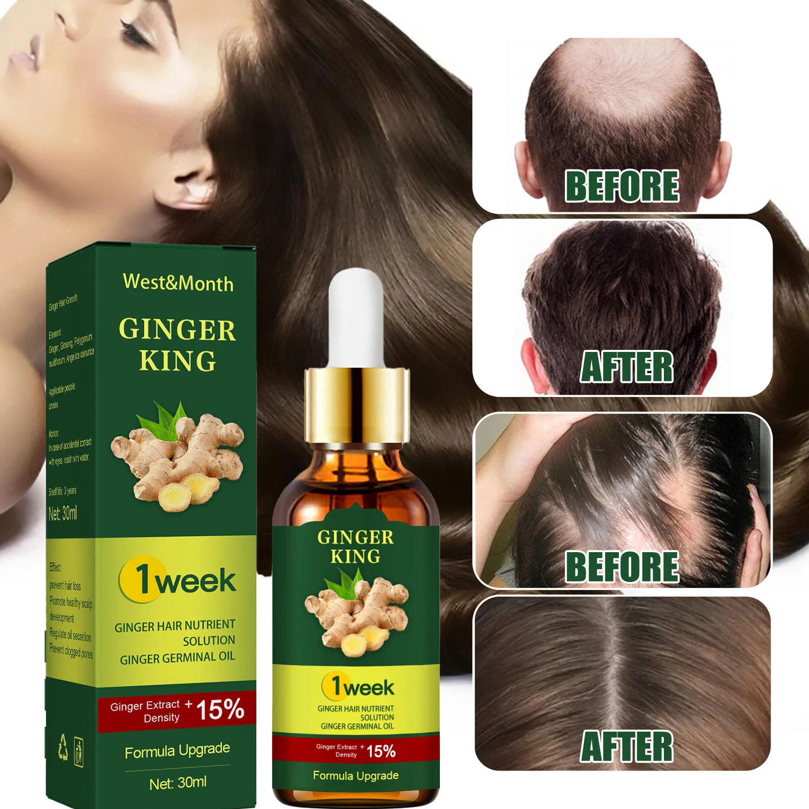 

Ginger Hair Growth Products Fast Growing Hair Essential Oil Beauty Hair Care Prevent Loss Scalp Treatment For Men Women 30ml