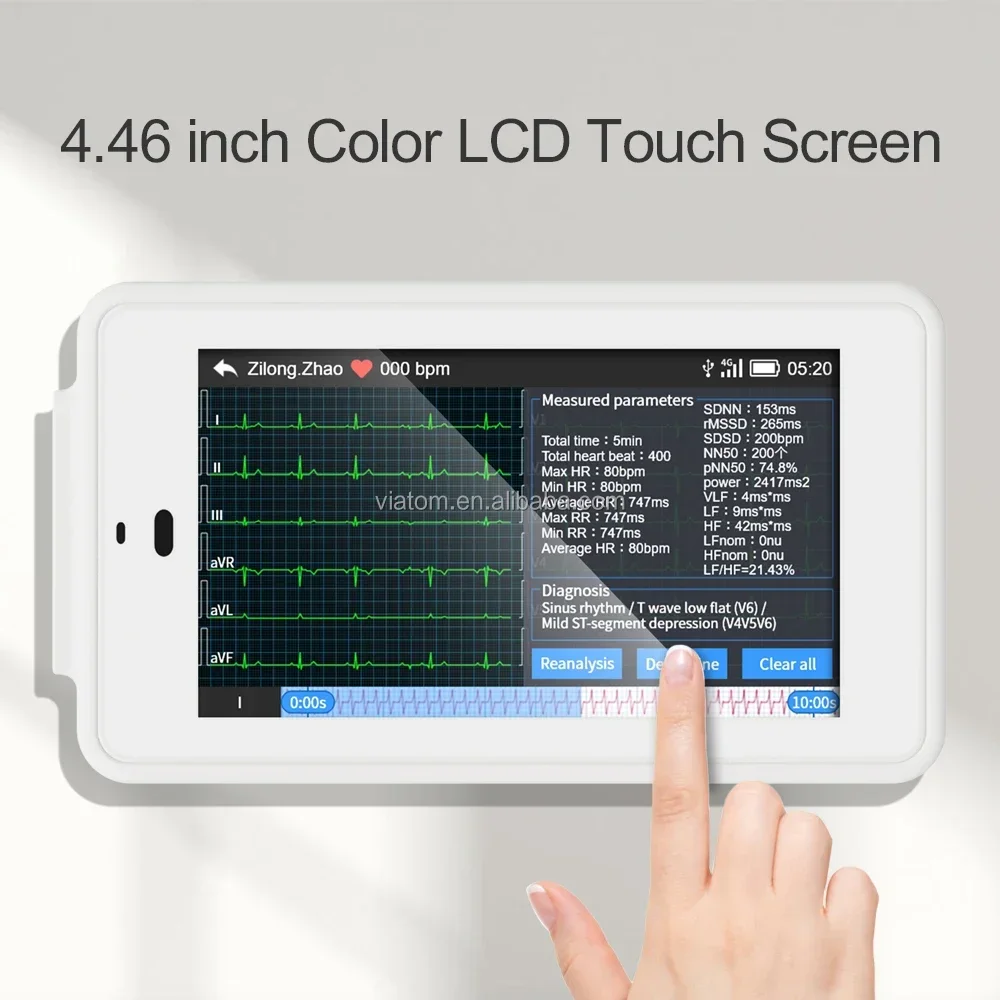Wellue PCeccg 500 Портативный эксg-машина 12-проводной эксцептор Холтер-рекордер