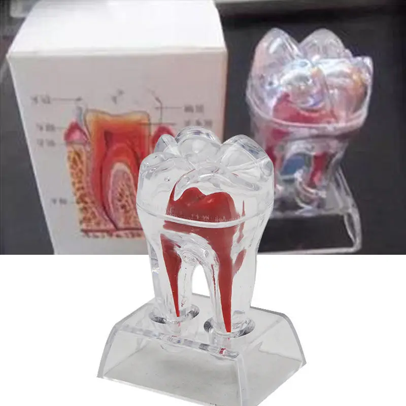 

Dentist Dental Crystal Base Hard Plastic Teeth Tooth Molar Model Separable