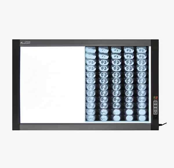 

Professional Economical Hospital Led Xray X-ray Film Viewer Negatoscope Xray