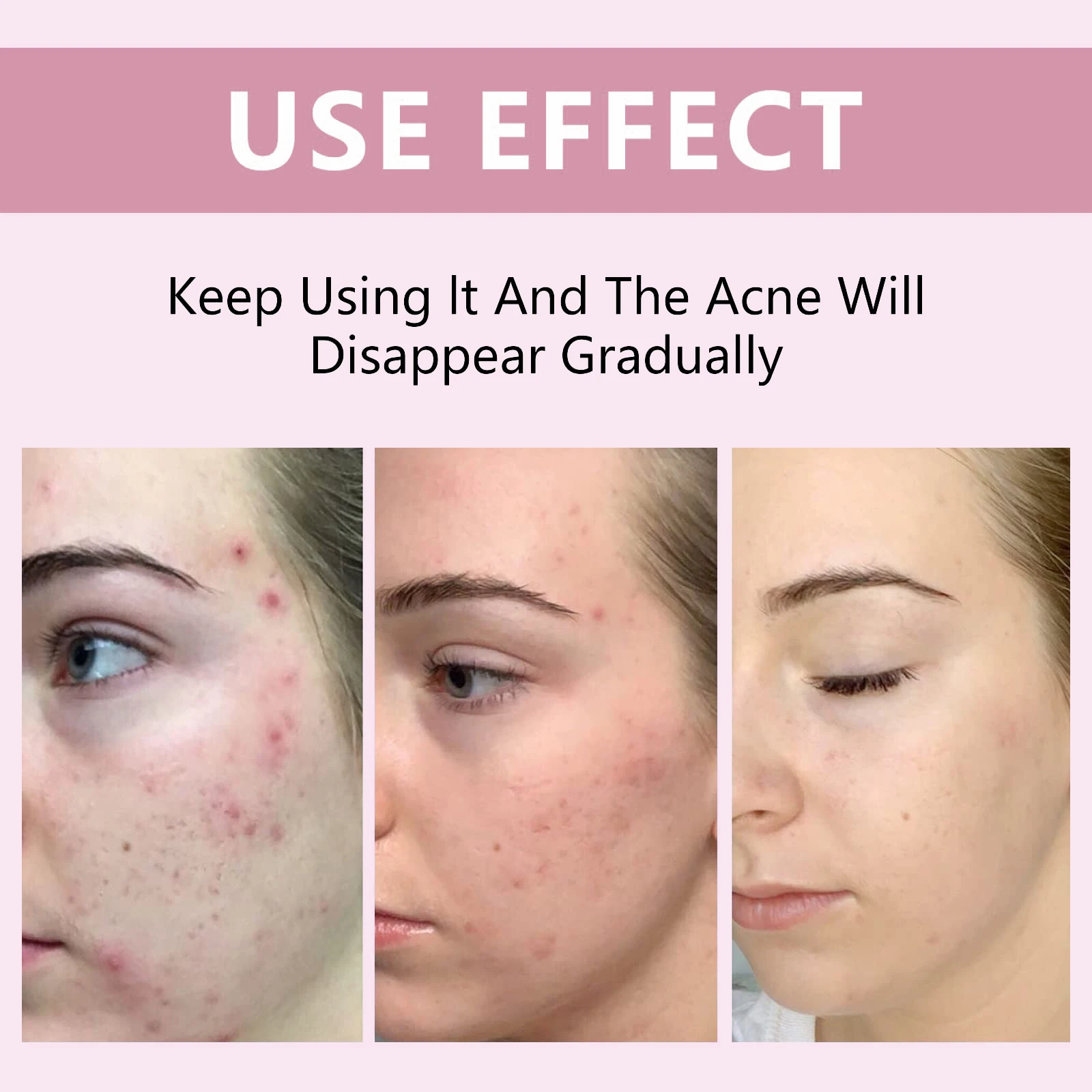 5 в 1, веганский увлажняющий увлажняющий крем против старения, осветляющий, укрепляющий, чувствительный к коже, витамин С, тоник для лица для сухой кожи (art.: 3920d4565862a) - 3920d4565862a