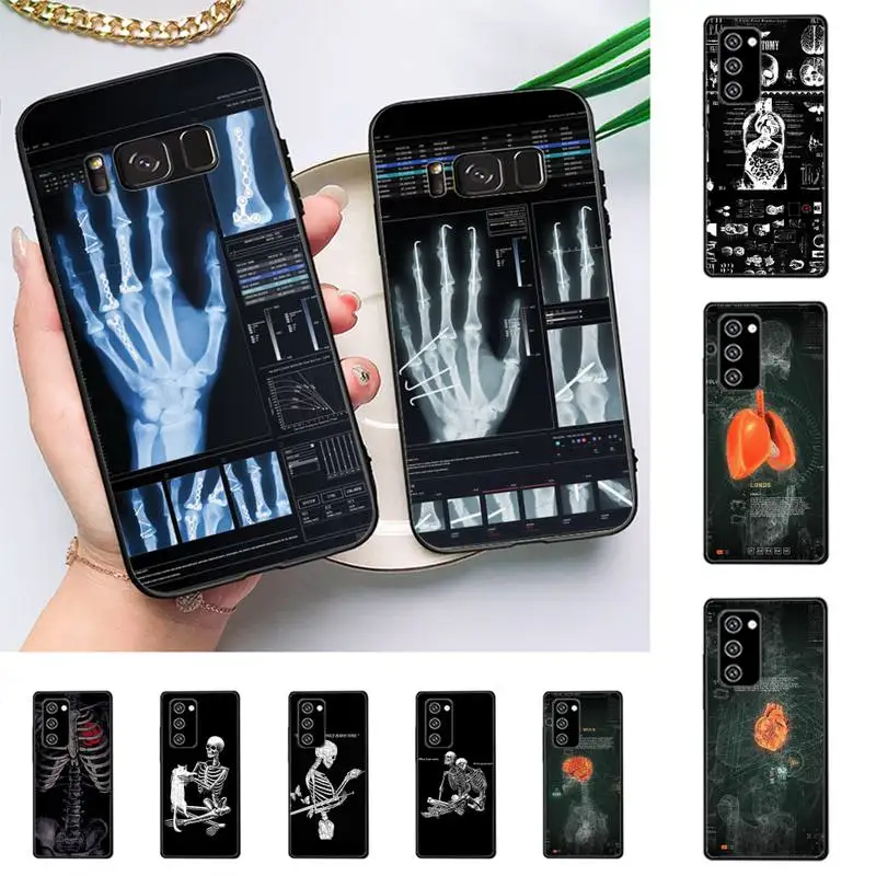 

Radiological human organs Skeleton skull Phone Case for Samsung Note 5 7 8 9 10 20 pro plus lite ultra A21 12 72