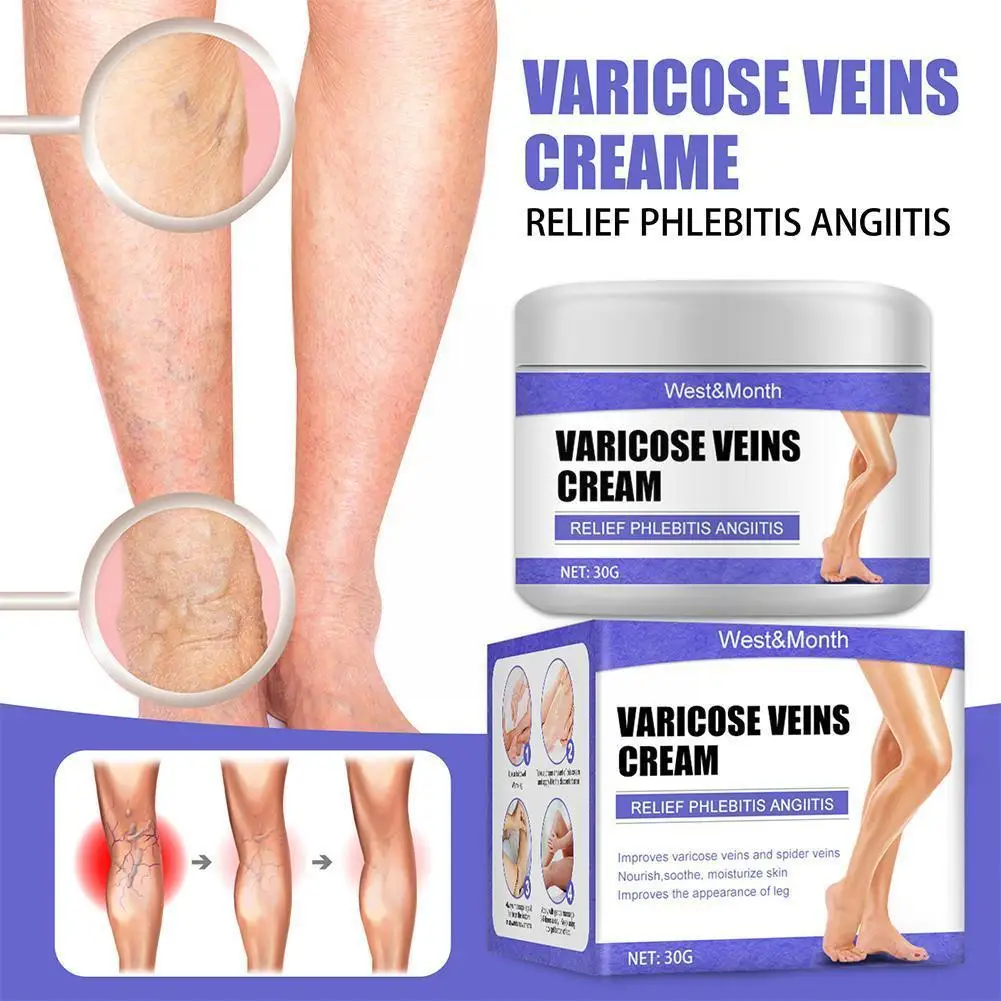 

Effective Varicose Veins Relief Cream Relieve Vasculitis Pain Ointment Treatment Care Phlebitis 30g Spider Plaster Body Med Z1V8