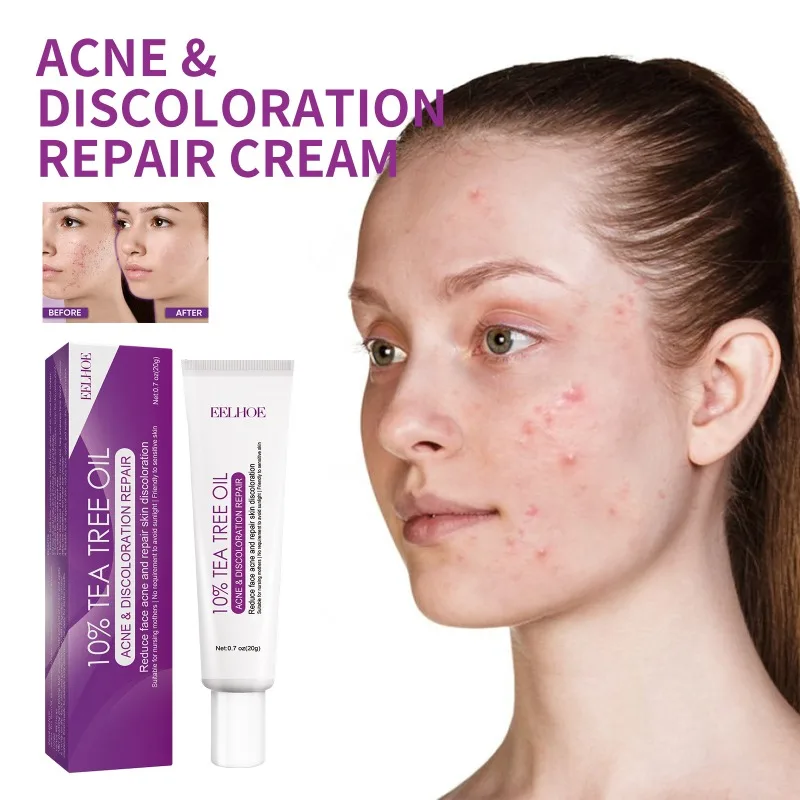 

Quickly Get Rid of Acne Cream Fade Spot Repair Cream Moisturizing Repair Dullness Brightening Cream Firming Skin Whitening Cream