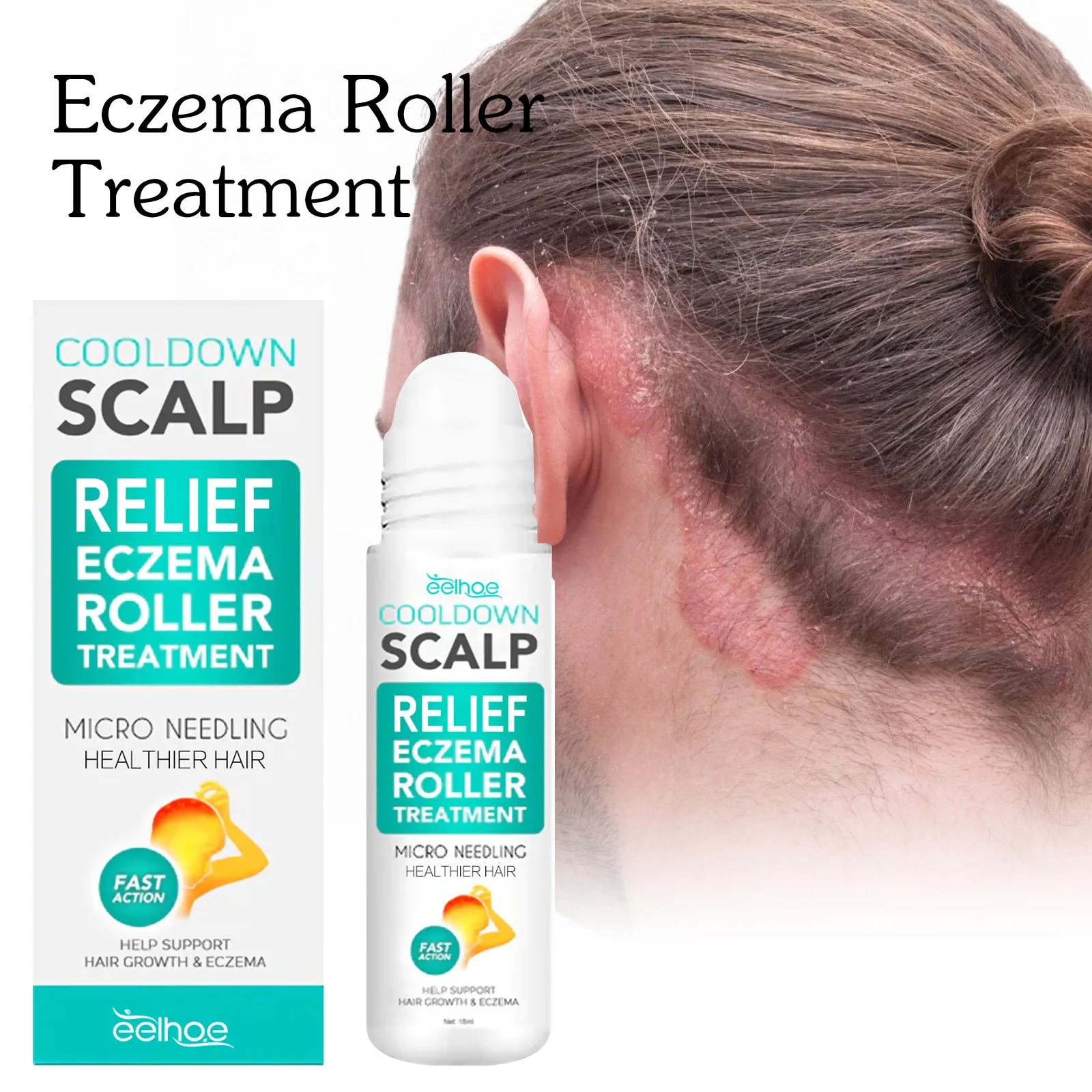 Seborrheic Dermatitis Cream Skin Care Treatments Repair Scalp Relieve Itching Remove Dandruff  Healthy Skin 18ml