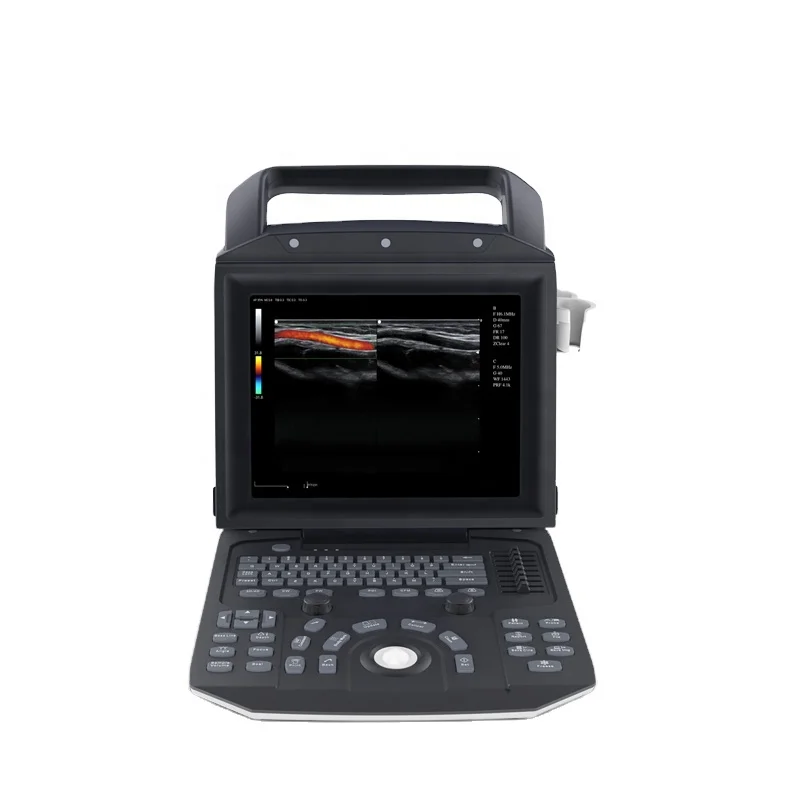 High Efficient New Hospital  4D Portable Color Doppler Ultrasound System Ultrasound Machine Price