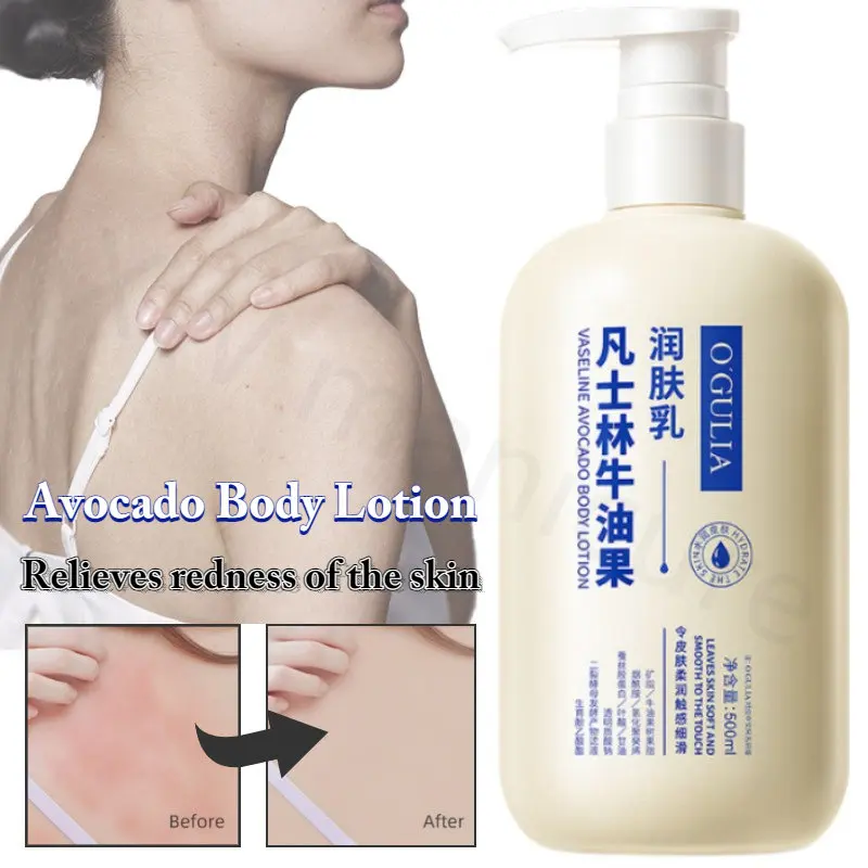 

Vaseline Avocado Moisturizing Anti-drying Body Lotion 500ml Skin Whitening Cream Exfoliation Relieves Dry Skin Body Care
