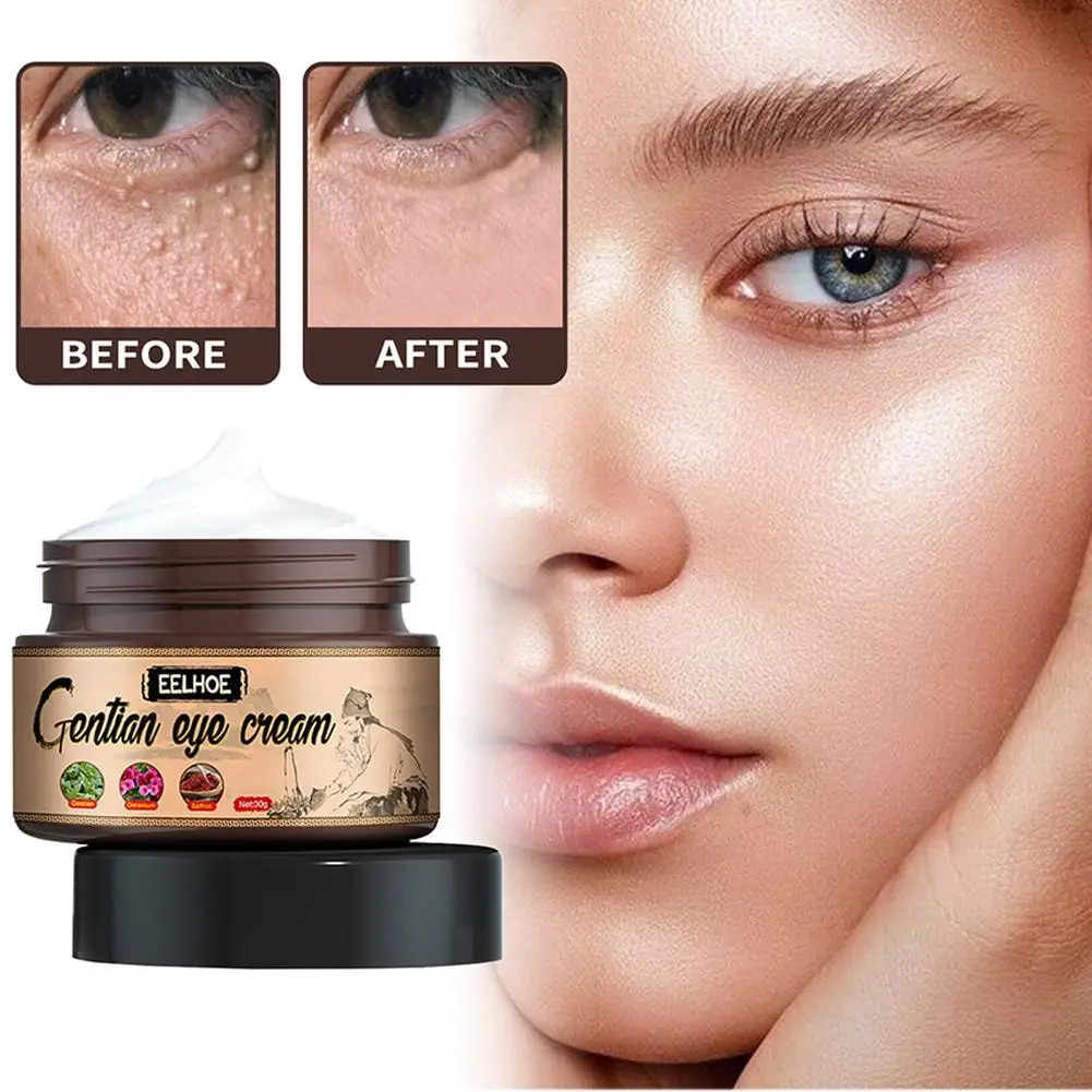 

Fat Remover Eye Cream Fat Granule Eye Serum Fade Fine Lines Eyes Dark Circles Firming Daily Wrinkle Treatment Skincare