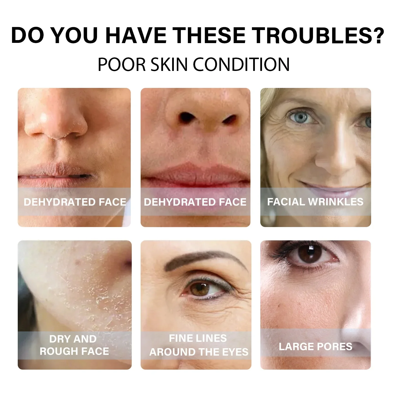 10p коллагеновые шелковые протеиновые нитки для лица абсорбируемый наполнитель