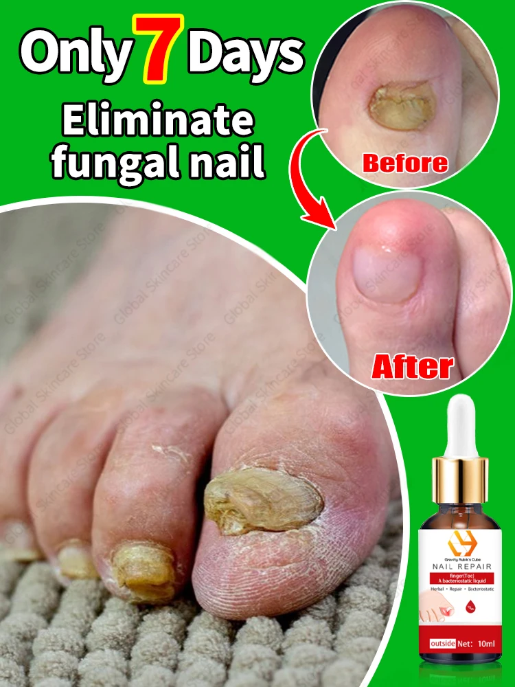 Ногти для ухода за ногами