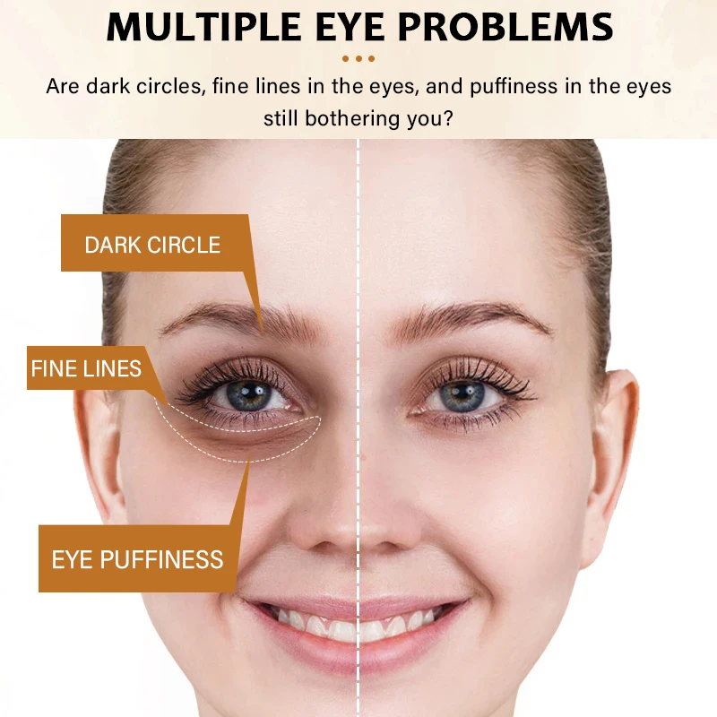 Ретинол питательная сыворотка для глаз укрепляющая лифтинг-кожа улучшение