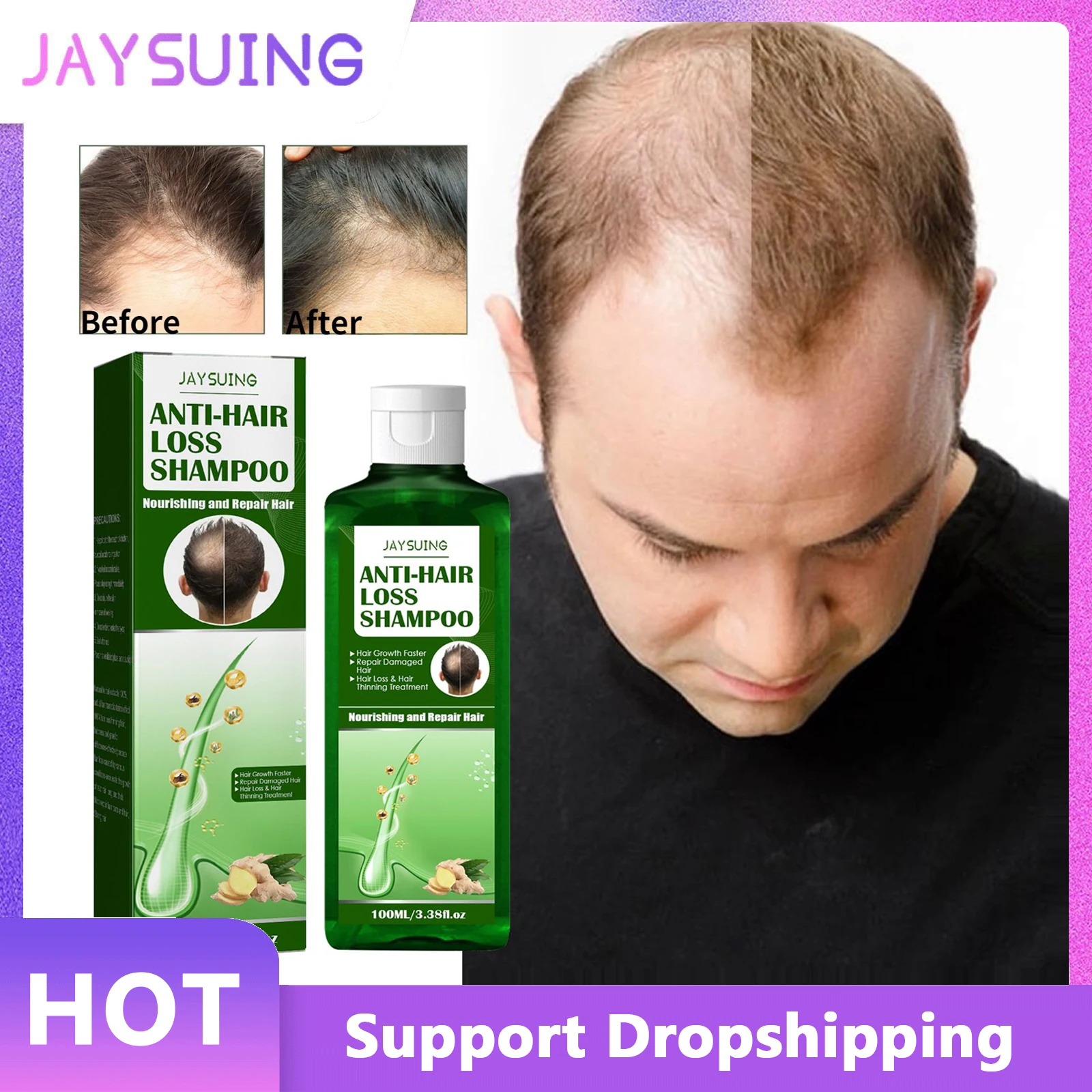 

Jaysuing Ginger Shampoo Hair Growth Dense Anti Hair Loss Deep Cleaning Oil Control Anti-itching Scalp Repair Shampoo Hair Care