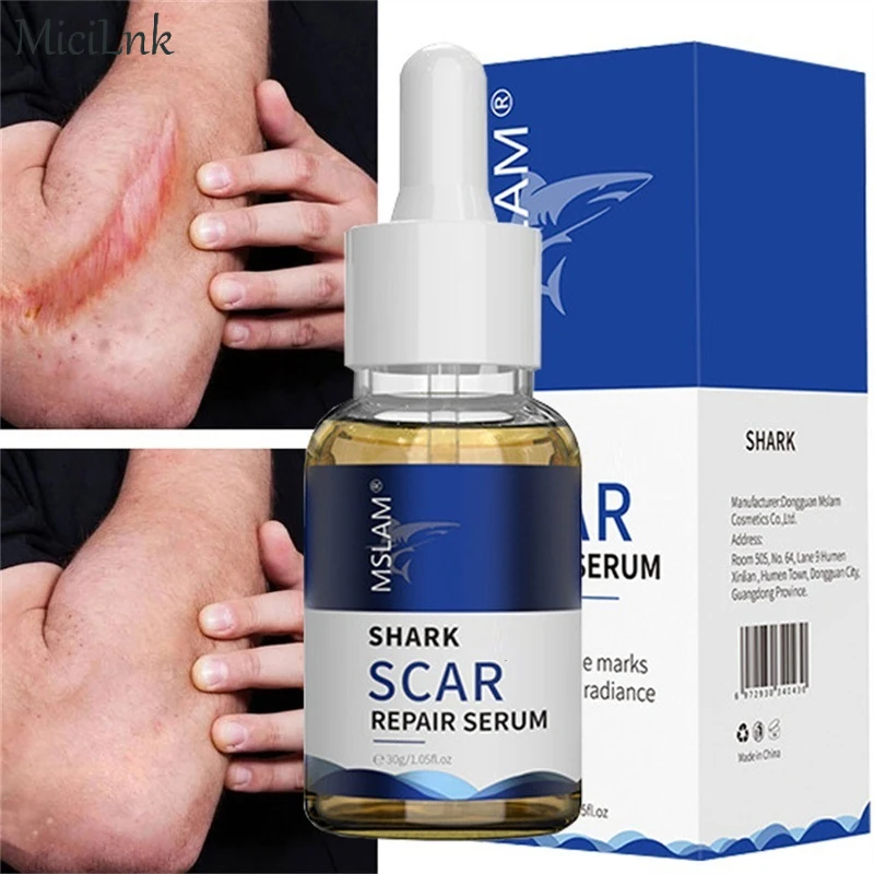 

Scar Removal Serum Stretch Marks Treatment Burn Surgical Remove Acne Spots Scar Repair Cream Smoothing Whitening Skin Beauty