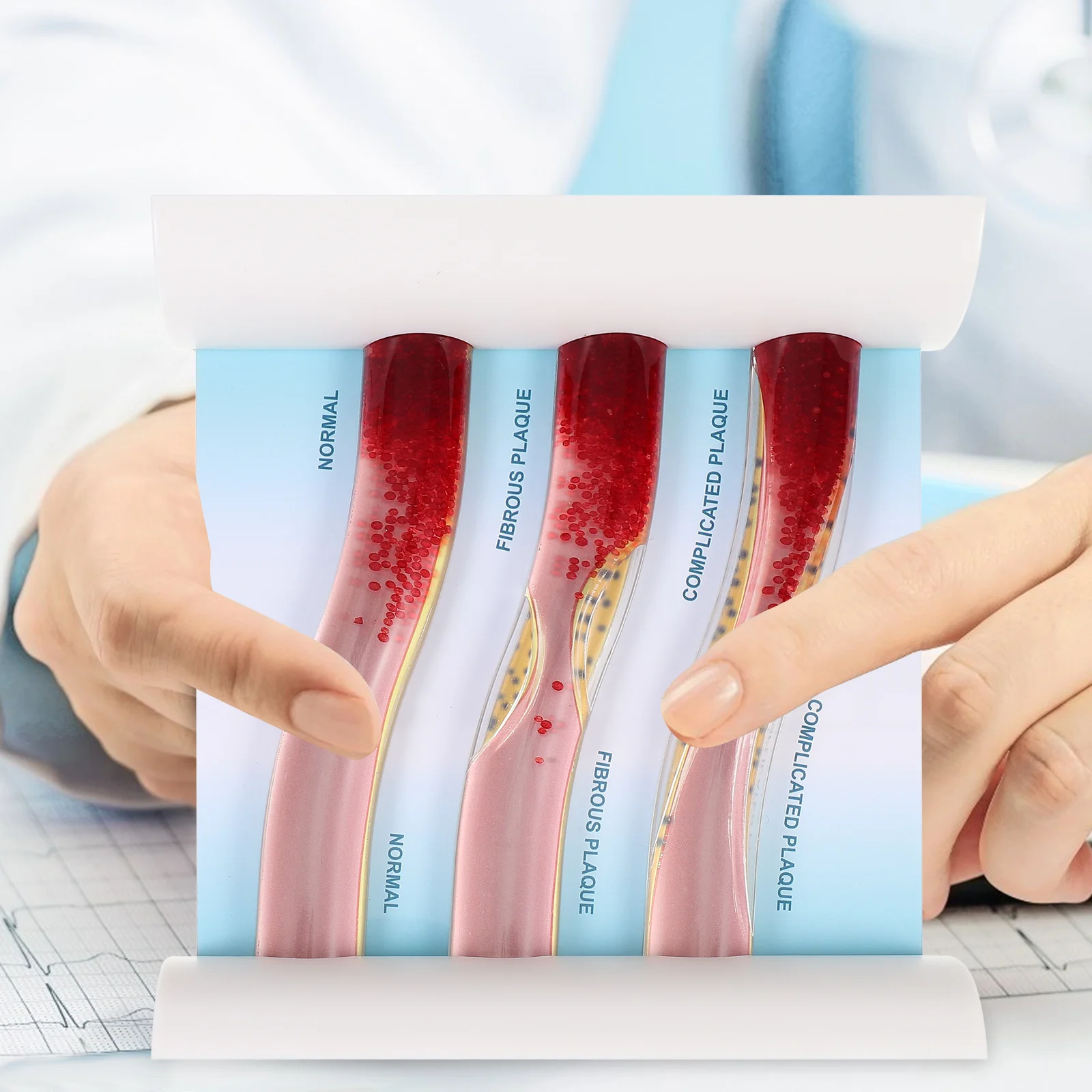 Рисунок 5 - Динамическая модель кровяного липида