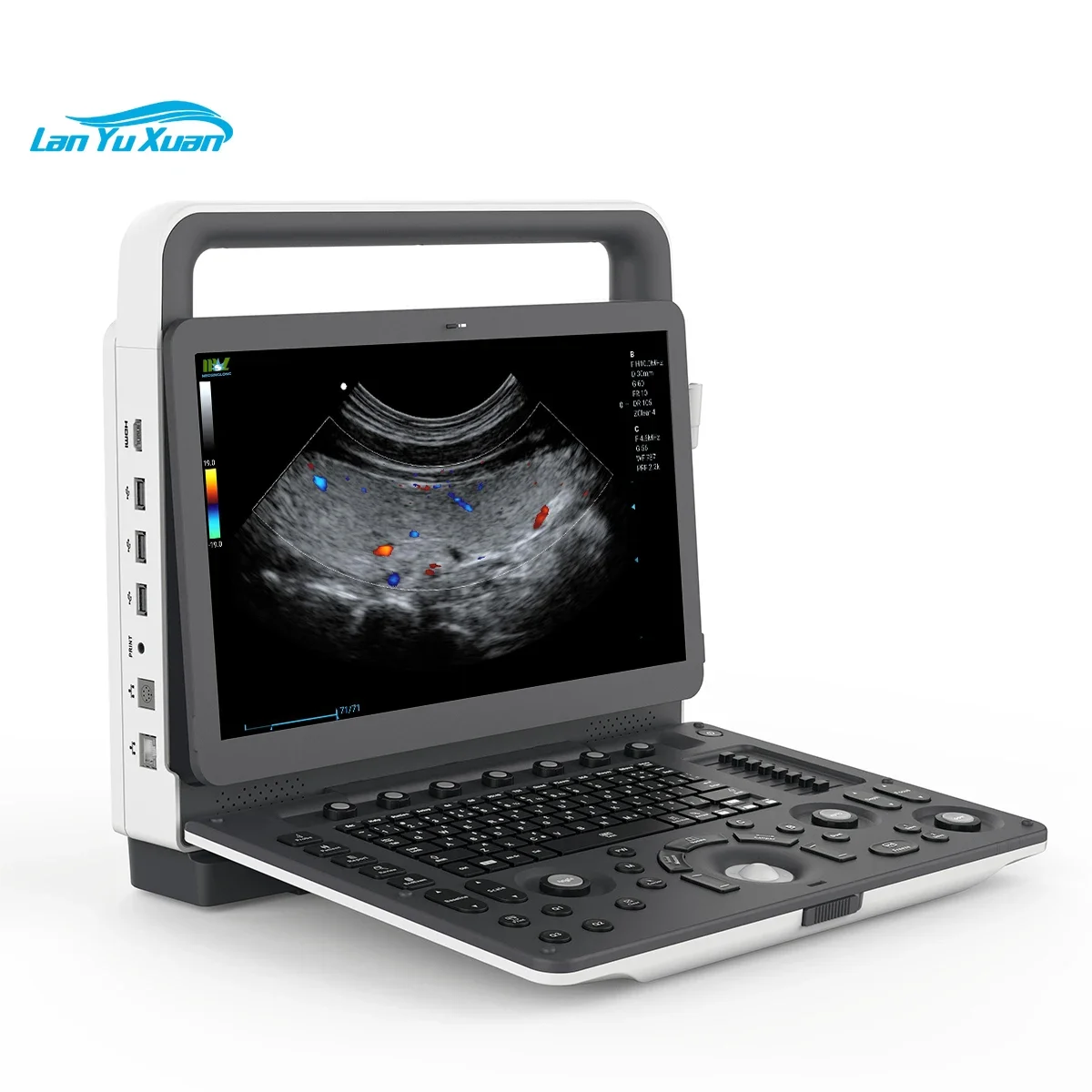 Рисунок 2 - Портативный ультразвуковой допплер