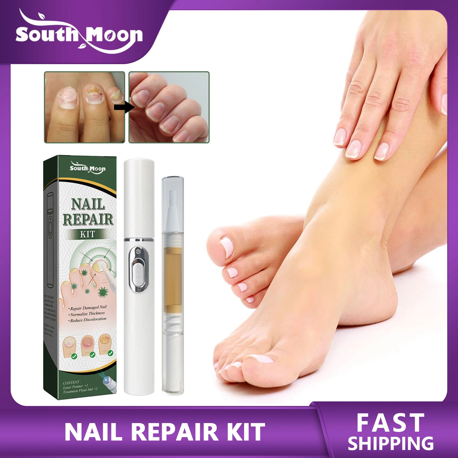 Nail Repair Pen Kit Anti-fungal Anti Infection Onychomycosis Fungus Care Toe Nail Treatment Hand and Foot Thickening Soft Nail