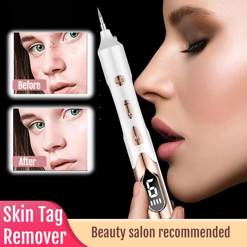 Skin Tag Remover Laser Plasma Pen for Freckle Black Dot Removal Papilloma Warts Mole Pimples Tattoo Remove Beauty Care Tools