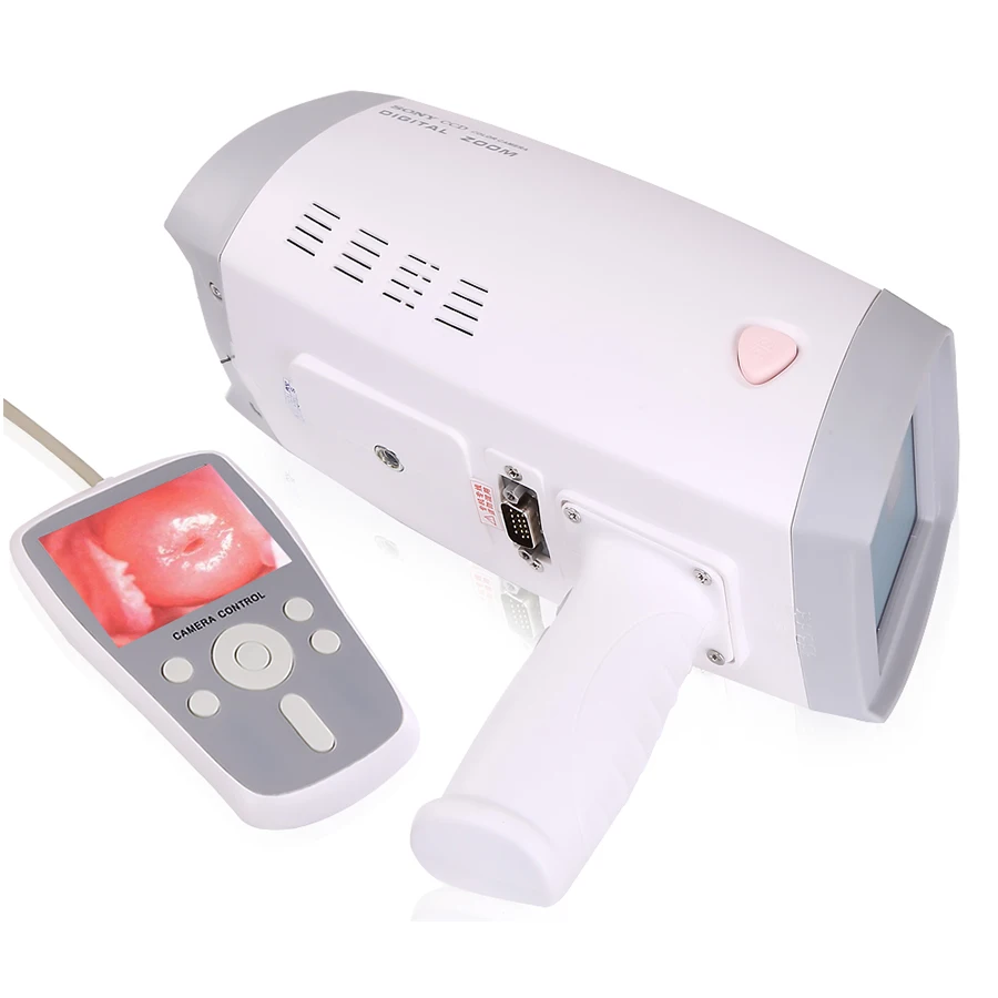 

cheap mini colposcope price