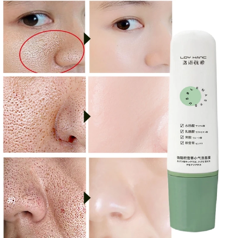 

Удаление черных точек самовспенивающаяся маска для сужения пор, контроль жирности, увлажнение, осветление тона кожи, маленькое пузырьковое...