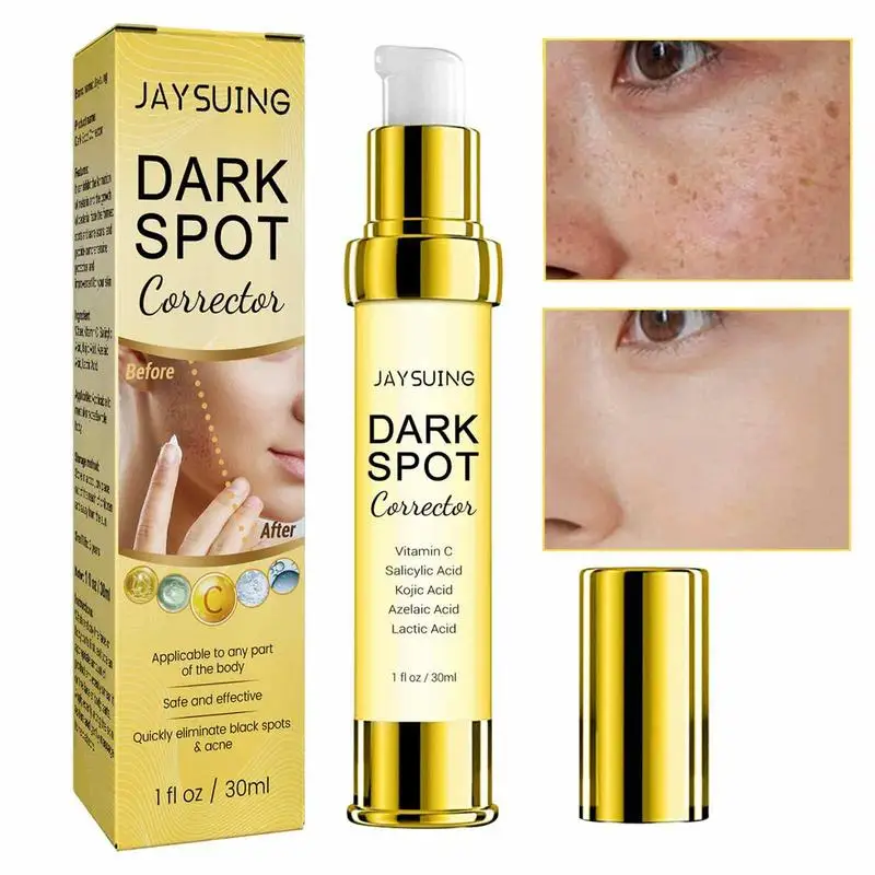

Dark Spot Remover Serum Blemish Spot Removal Cream Freckle Spot Corrector Cream Face Serum For Sun Burn Age Spots Brown Spots