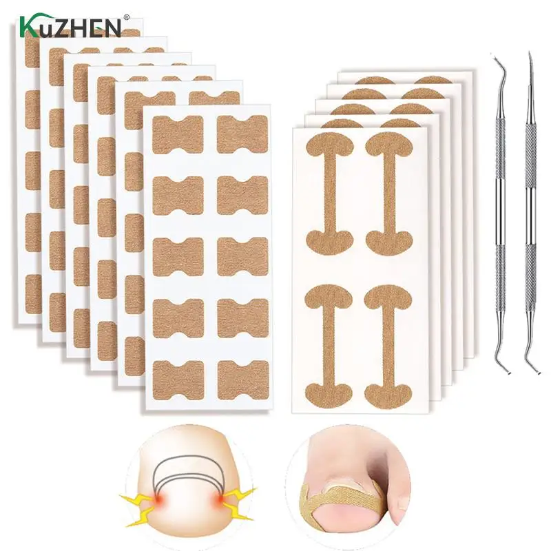 

1 Set Elasticity Toe Nail Care Pedicure Tools Health Care Protects Toe Nail Professional Ingrown Toenail Foot Corrector Stickers